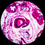 lymph gland tissue